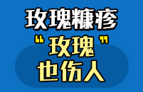 绍兴华肤皮肤病医院，引发玫瑰糠疹不良习惯有哪些